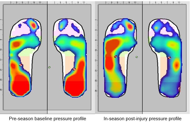 Example of monitoring during the regular season after an injury.