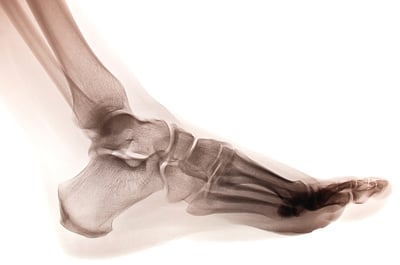 foot and ankle xray